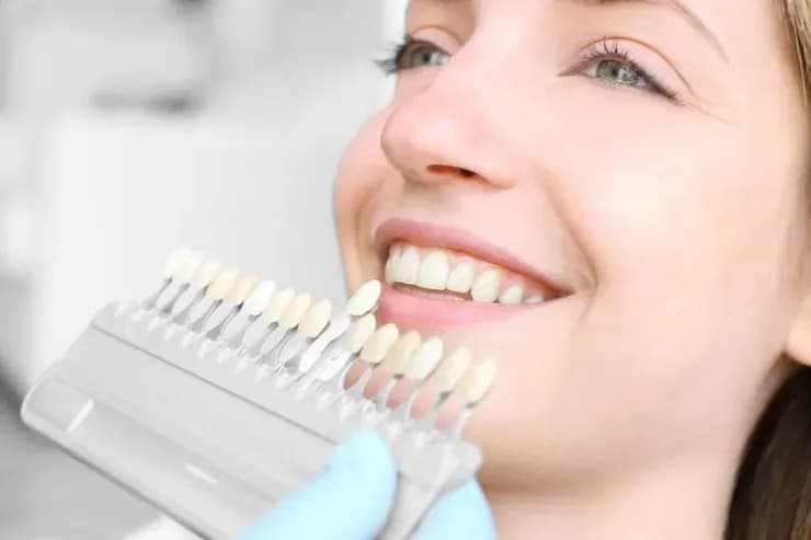 Ceramic Veneers in Surat Ceramic Veneers-in-Surat