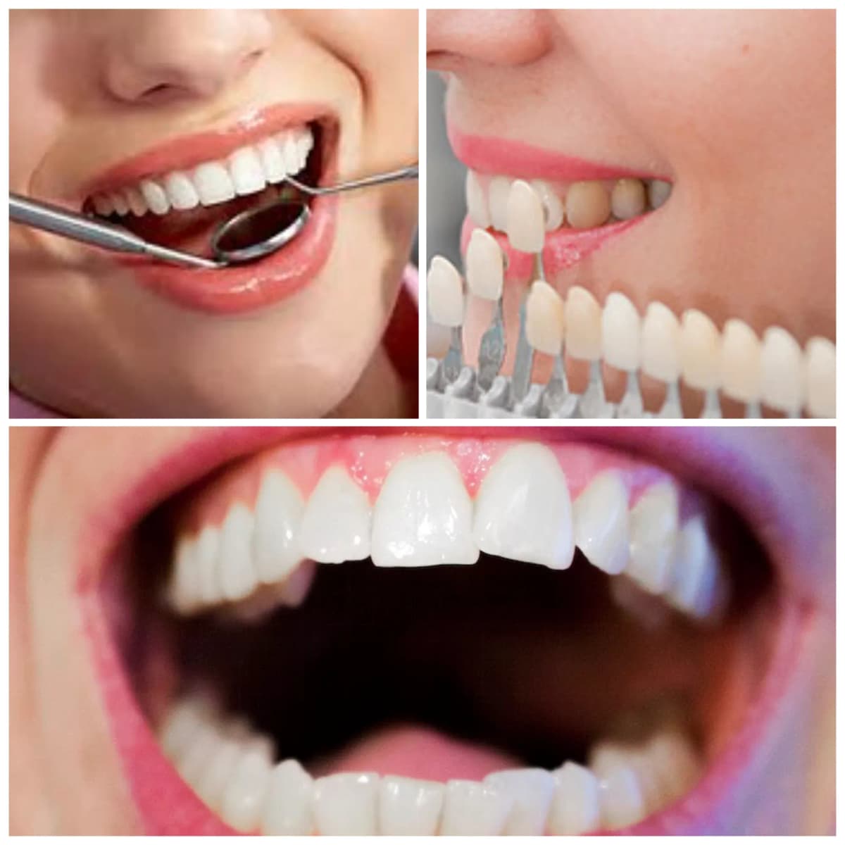 Complete Smile Transformation in Surat Complete Smile Transformation-in-Surat